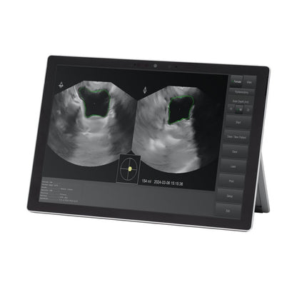 Vitascan LT Bladder Scanner with Chuwi Tablet