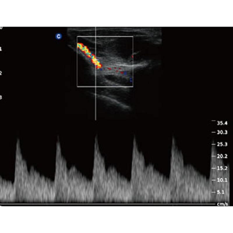 QBit 5 Ultrasound Machine with battery