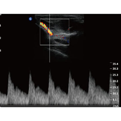 QBit 5 Ultrasound Machine with battery