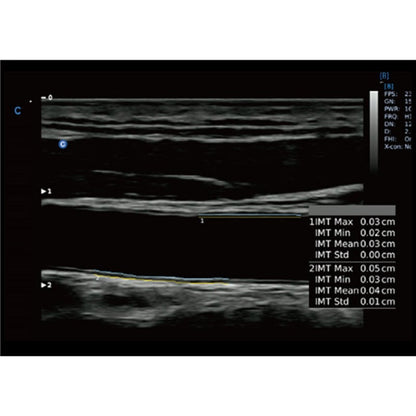 CBit6 Ultrasound Machine with battery