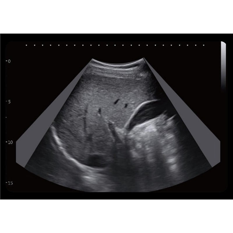 CBit6 Ultrasound Machine without battery