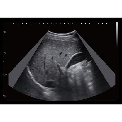 CBit6 Ultrasound Machine without battery