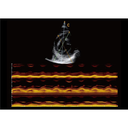 CBit6 Ultrasound Machine with battery
