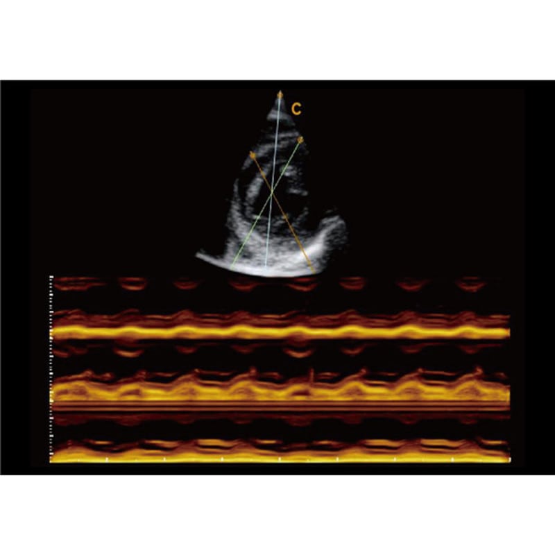 CBit6 Ultrasound Machine without battery
