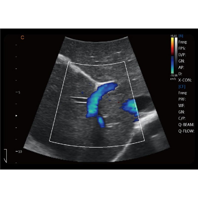 CBit6 Ultrasound Machine without battery