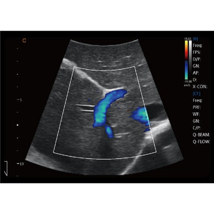 CBit6 Ultrasound Machine without battery