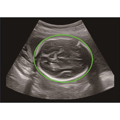 CBit6 Ultrasound Machine with battery