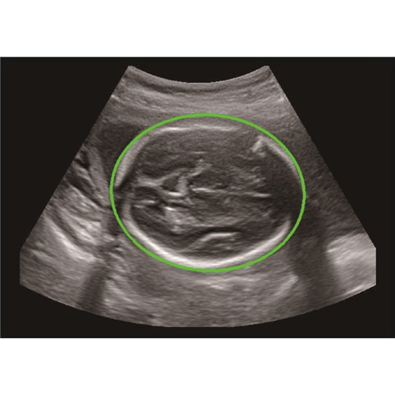 CBit6 Ultrasound Machine without battery