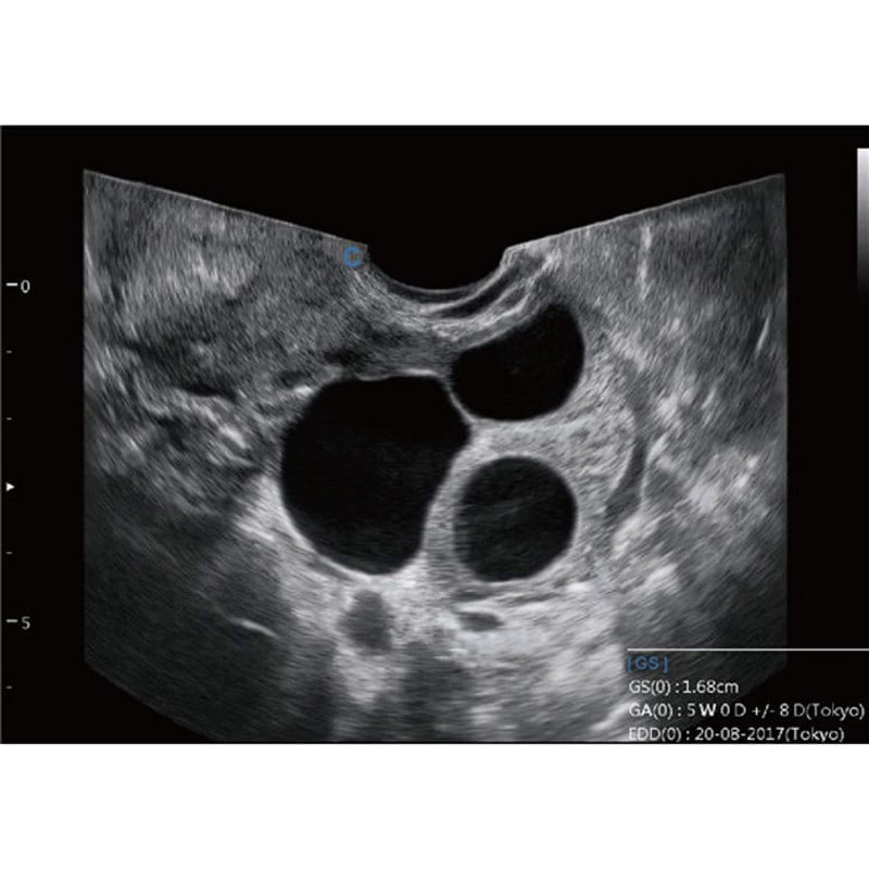 CBit6 Ultrasound Machine without battery