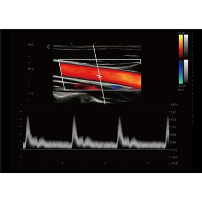 CBit 9 Color Doppler Ultrasound System with battery