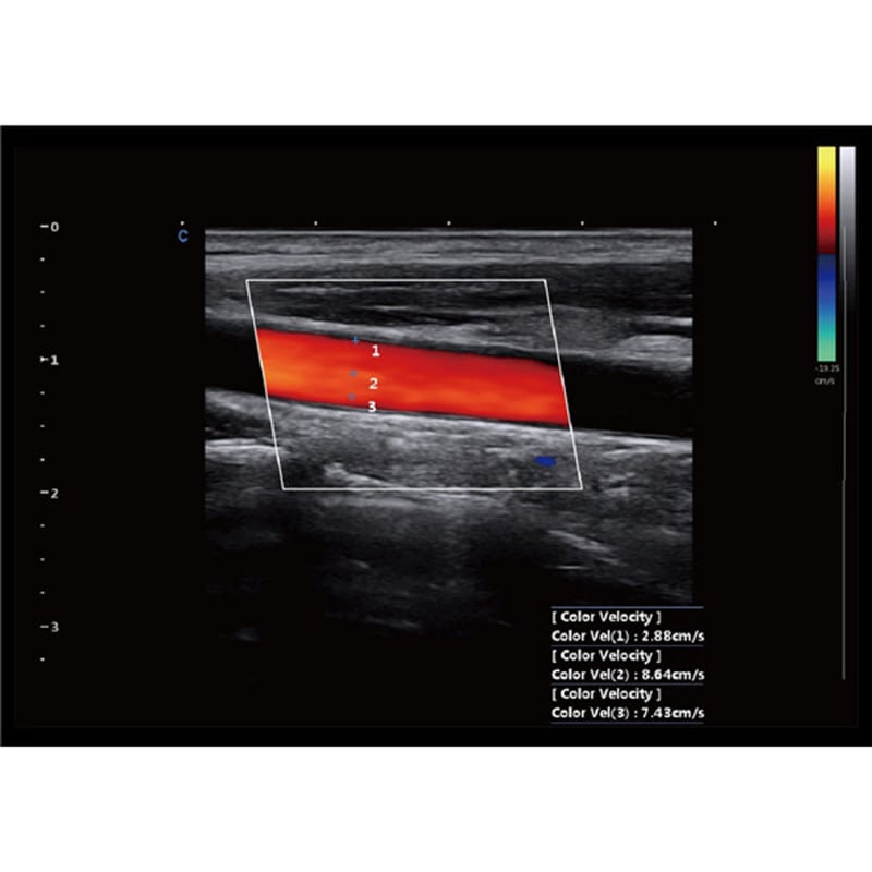 CBit 9 Color Doppler Ultrasound System without battery