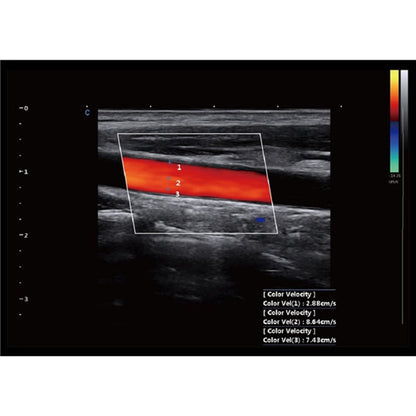 CBit 9 Color Doppler Ultrasound System without battery