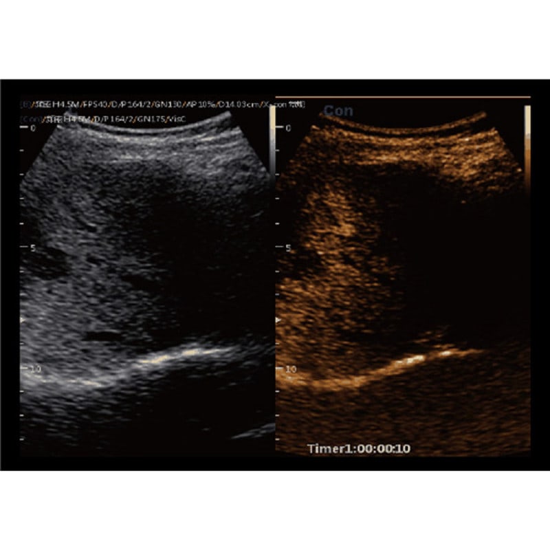 CBit 9 Color Doppler Ultrasound System without battery