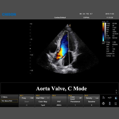 QBit 7 Ultrasound System