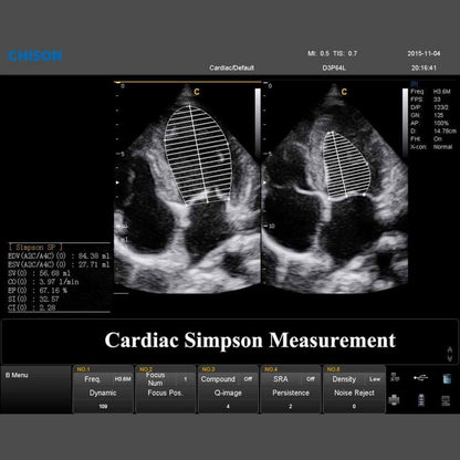 QBit 7 Ultrasound System