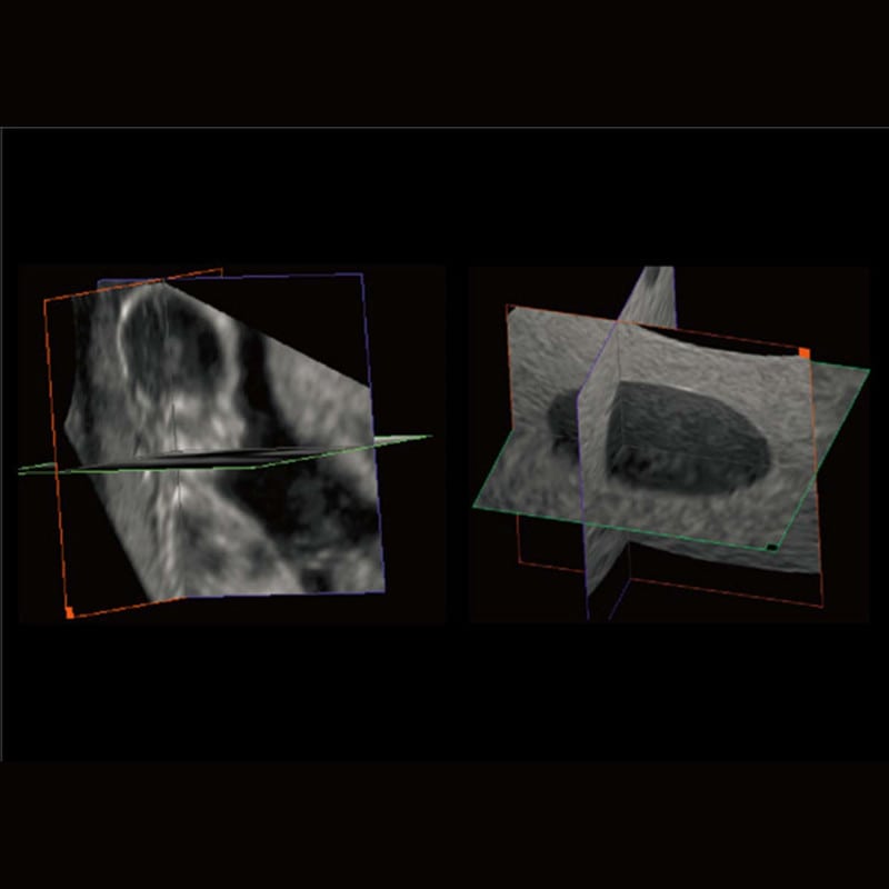 CBit 4 Ultrasound System