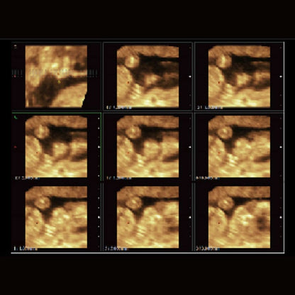 CBit 4 Ultrasound System