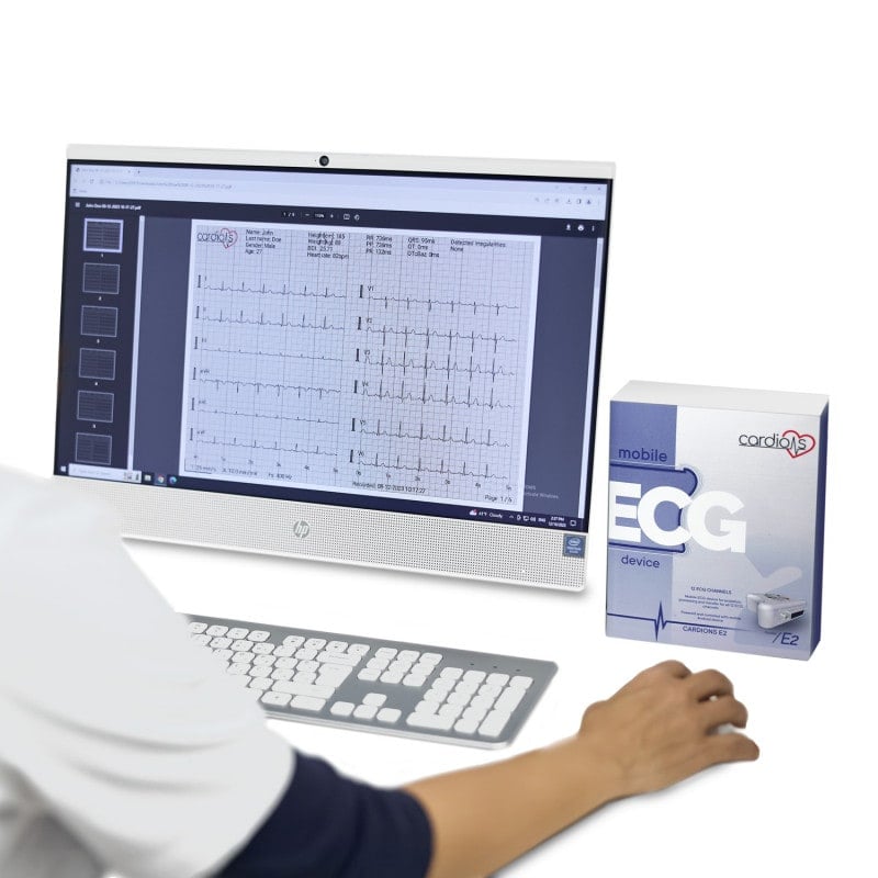 CardioNS E2 with snap-button cable | with tablet