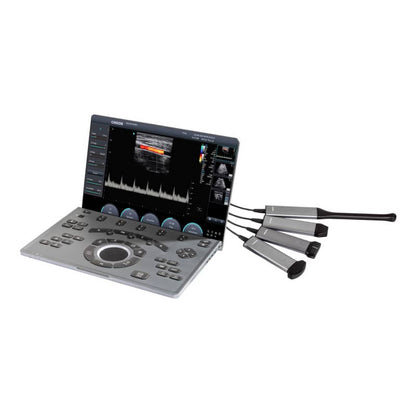 CHISON SonoAir 30 with trolley