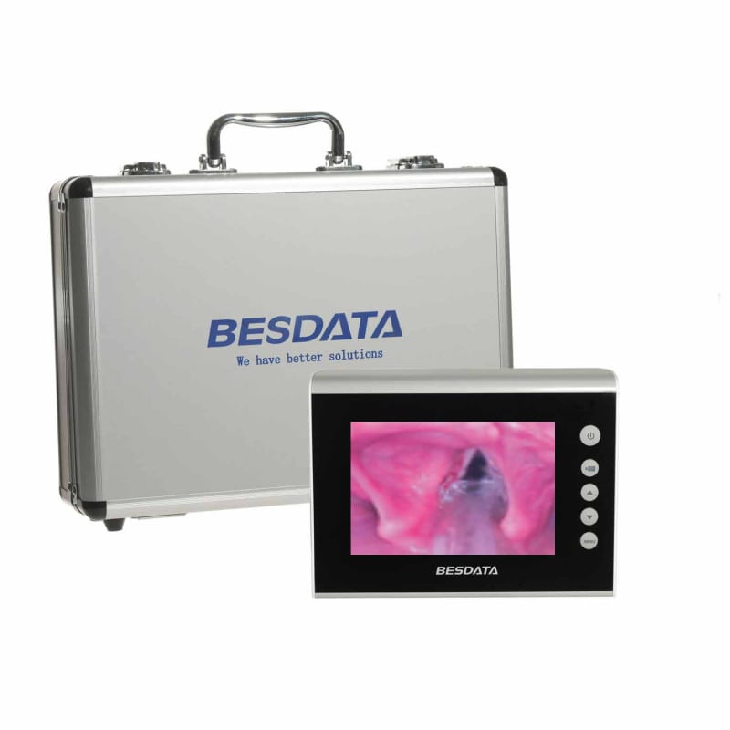 Bronchoscopy Monitor