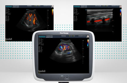 SonoScape S11 Plus ultrasound system battery included