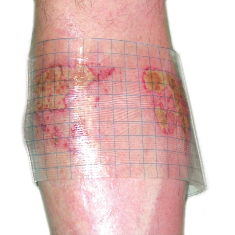 HydroTac transparent Gel Dressing 20 cm x 20 cm