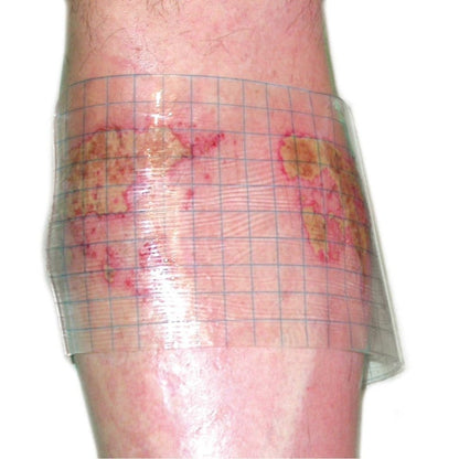 HydroTac transparent Gel Dressing 20 cm x 20 cm