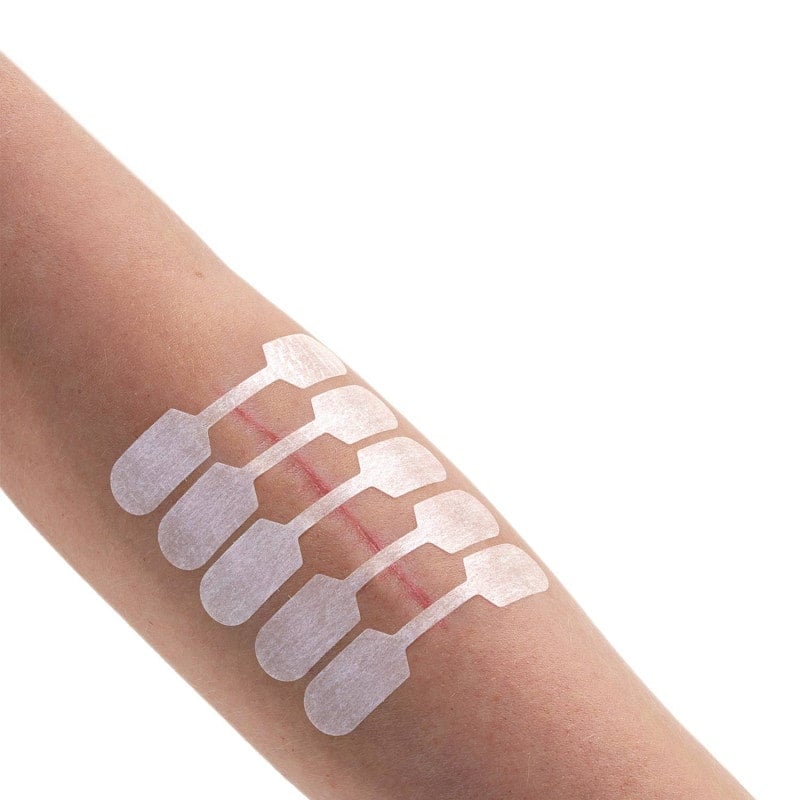 Sterigrap Wound Closure Strips Strips, 100 x 12 mm (6 PCS)