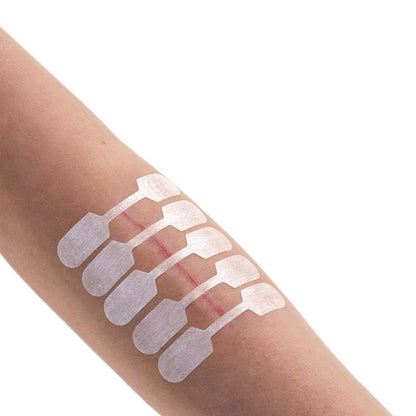 Sterigrap Wound Closure Strips Strips, 100 x 6 mm (10 PCS)