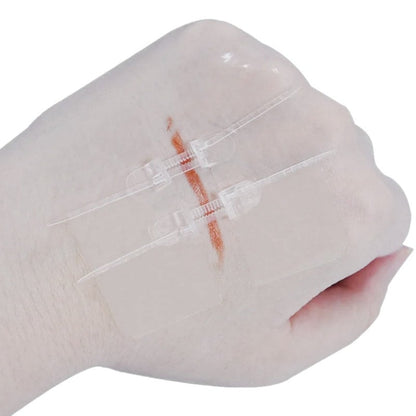 Zip Wound Closure Device G1 6 x 20 cm