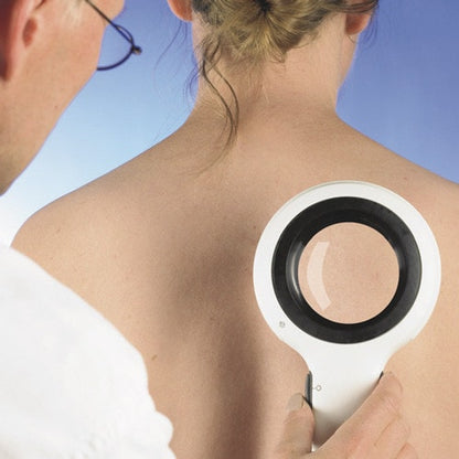 DermLite Lumio, Magnifying Light Dermatoscope UV-LED