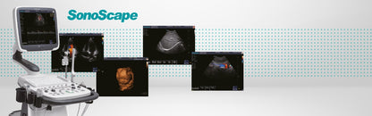 SonoScape S11 Plus ultrasound system without battery