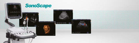 SonoScape S11 Plus ultrasound system without battery