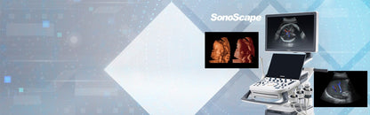 Sonoscape P15 Ultrasound Machine without battery