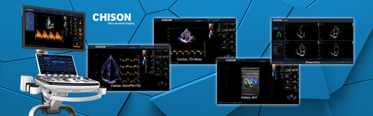 XBit 80 Color Doppler Ultrasound System without battery