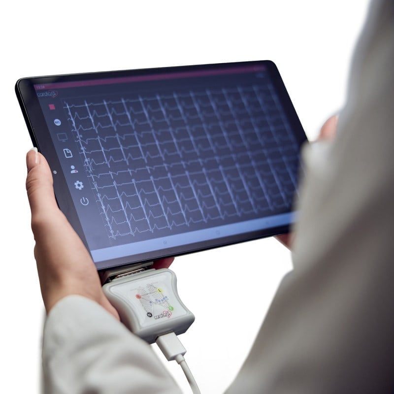 CardioNS E2 with banana plug cable | without tablet